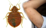 Bed Bugs Control Services Awesomepest